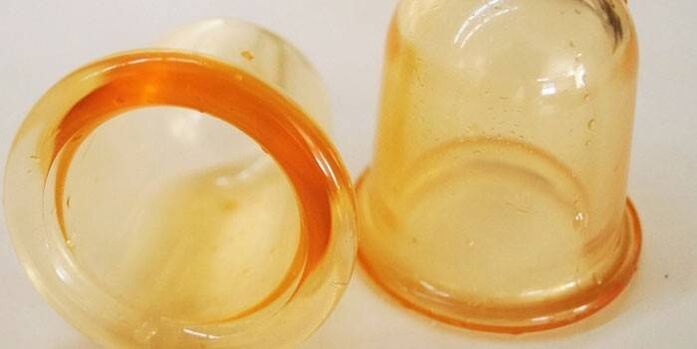 poháre na liečbu prostatitídy